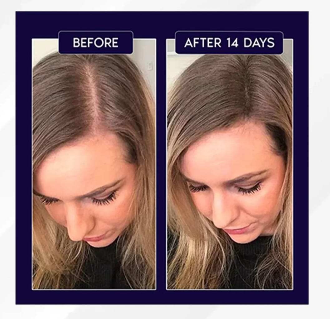 FEG PLUS Hair Growth Spray 50ml