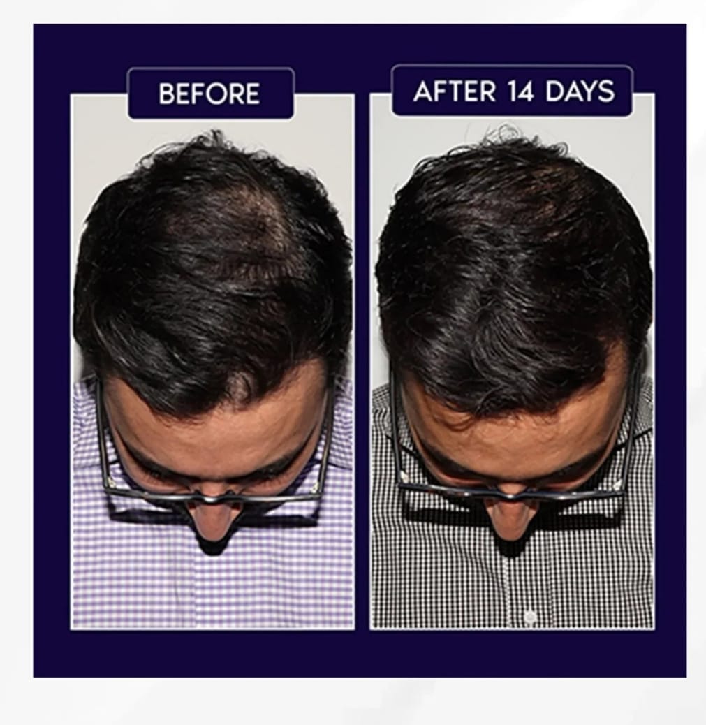 FEG PLUS Hair Growth Spray 50ml